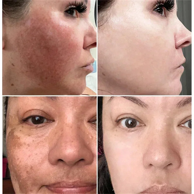 Powerful Spot-Removing Whiten  - Skincare Korea ulasan dan harga
