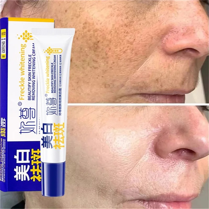 Powerful Spot-Removing Whiten  - Skincare Korea ulasan dan harga