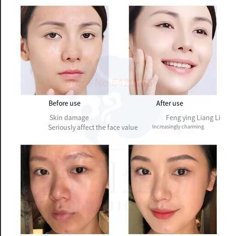 0.25 mm Microneedle GHK-Cu Blu - Licorice Root Extract ulasan dan harga