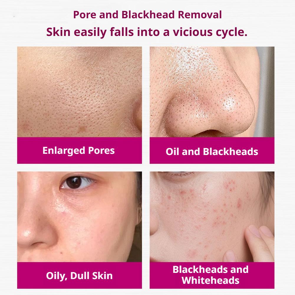 Salicylic Acid Shrink Pores Se - Skincare Skintific ulasan dan harga